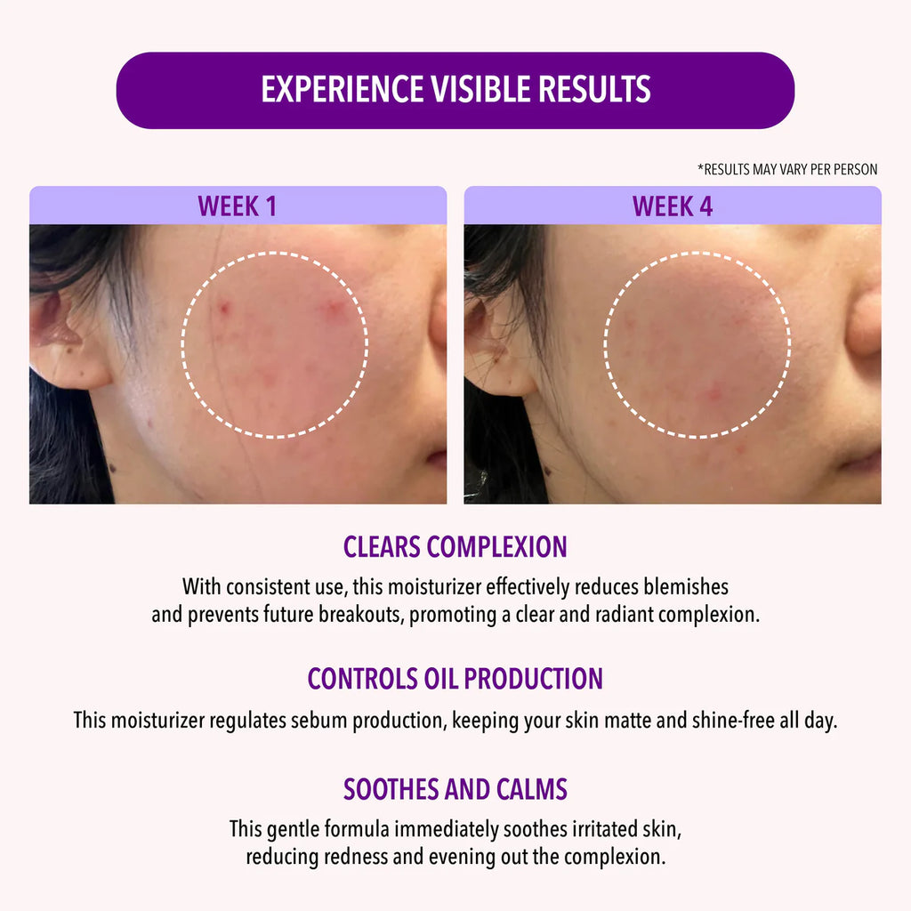 10% NIACINAMIDE OIL CONTROL MOISTURIZER